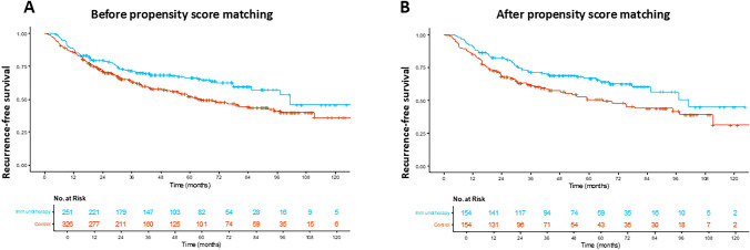 Recurrence-free survival before ( A ) and after ( B ) propensity score matching in real-world population